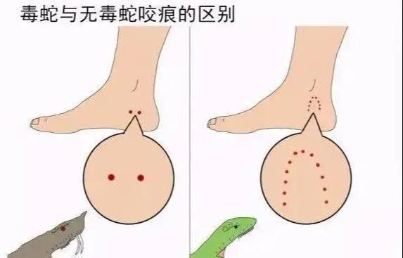 女子被蛇咬伤身亡后续:卫健委介入!家属质疑医院女孩真容被曝(图5)