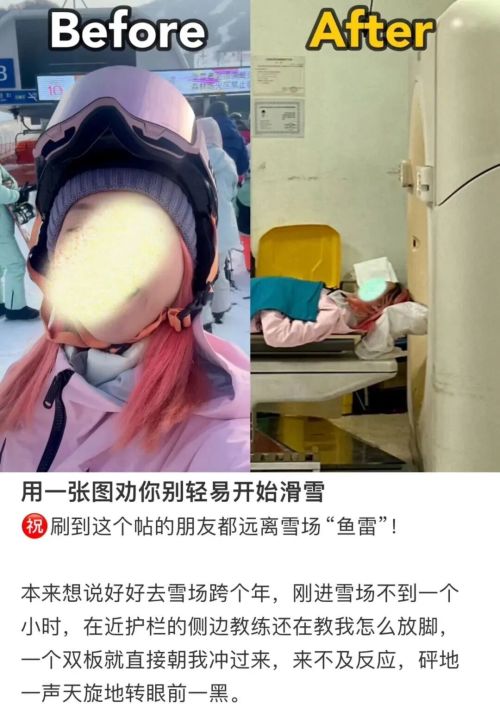 2026年第一批滑雪的人已骨折(图10)