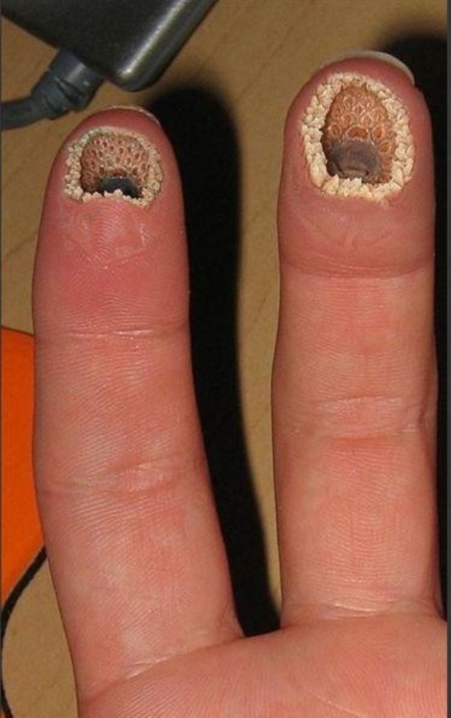 为什么看到“密集”的东西有人感到浑身难受？