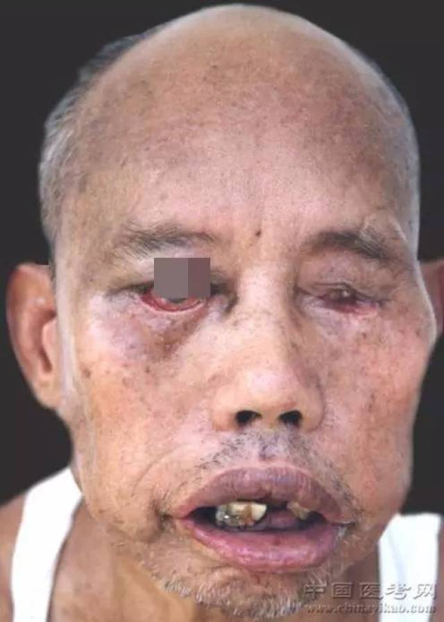 福建渔民试养绿鳍马面鲀育苗获得成功